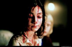 Bloody face