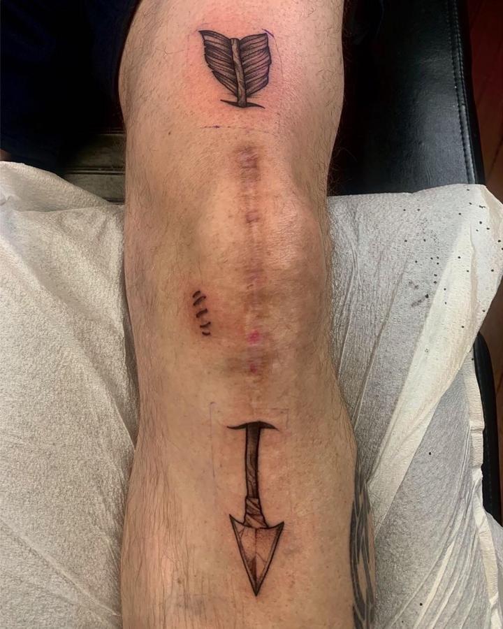 arrow to the knee - ouch