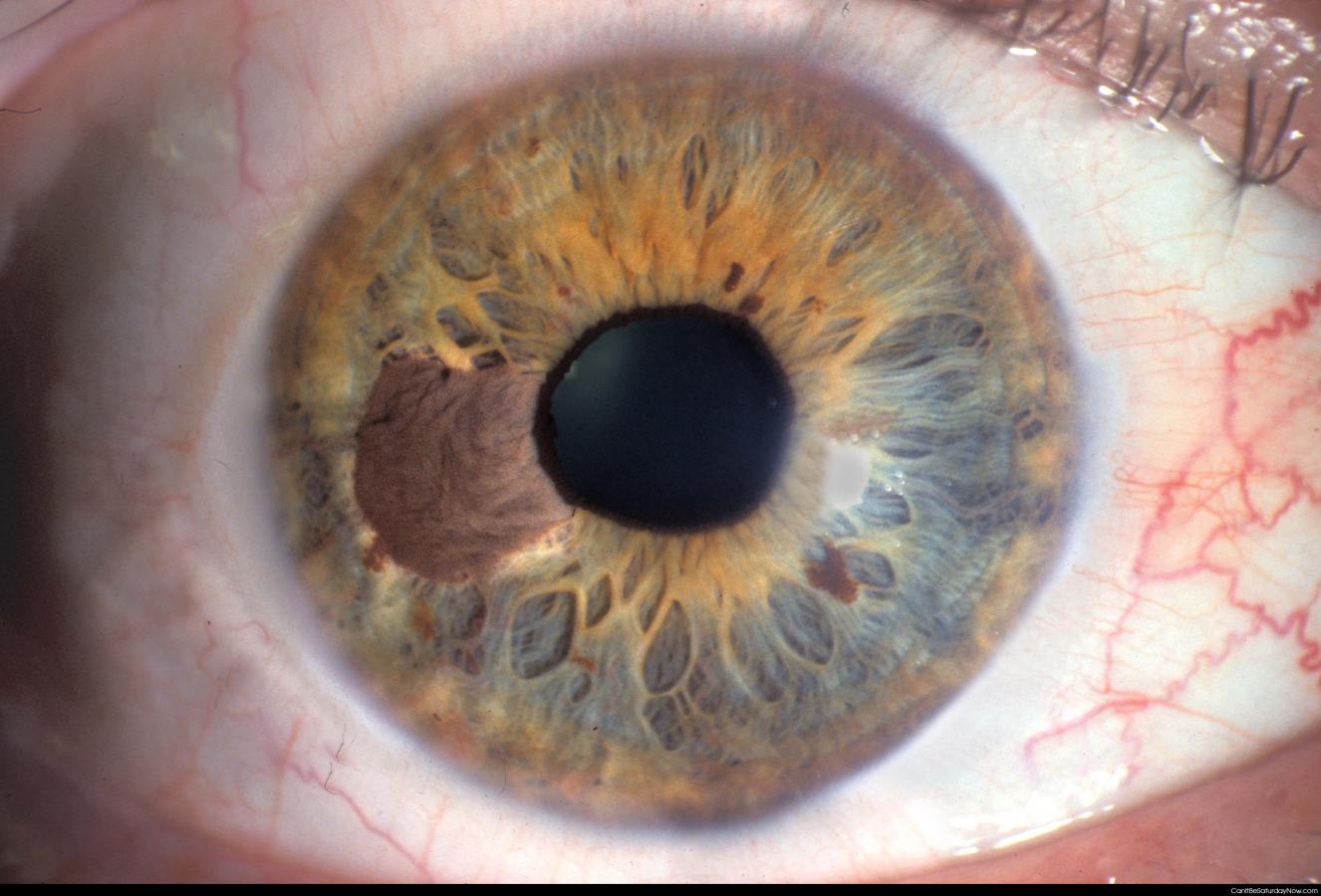 Eye 2 - close up of an eye