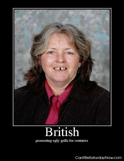 British - they have bad teeth